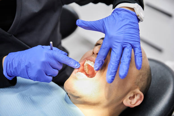 Best Broken or Chipped Tooth Repair in Hubbard, TX